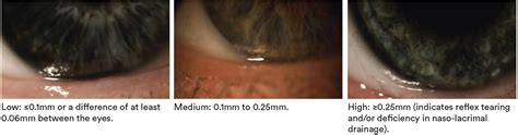 how to measure tears in eyes